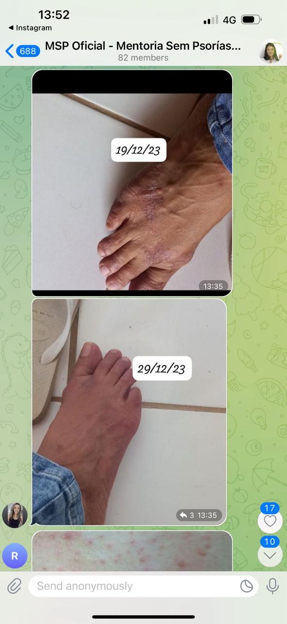 Comparativo da evolução nos pés