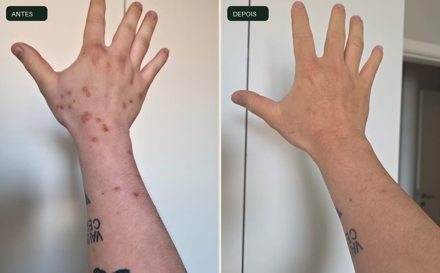 Comparativo de mãos antes e depois do protocolo